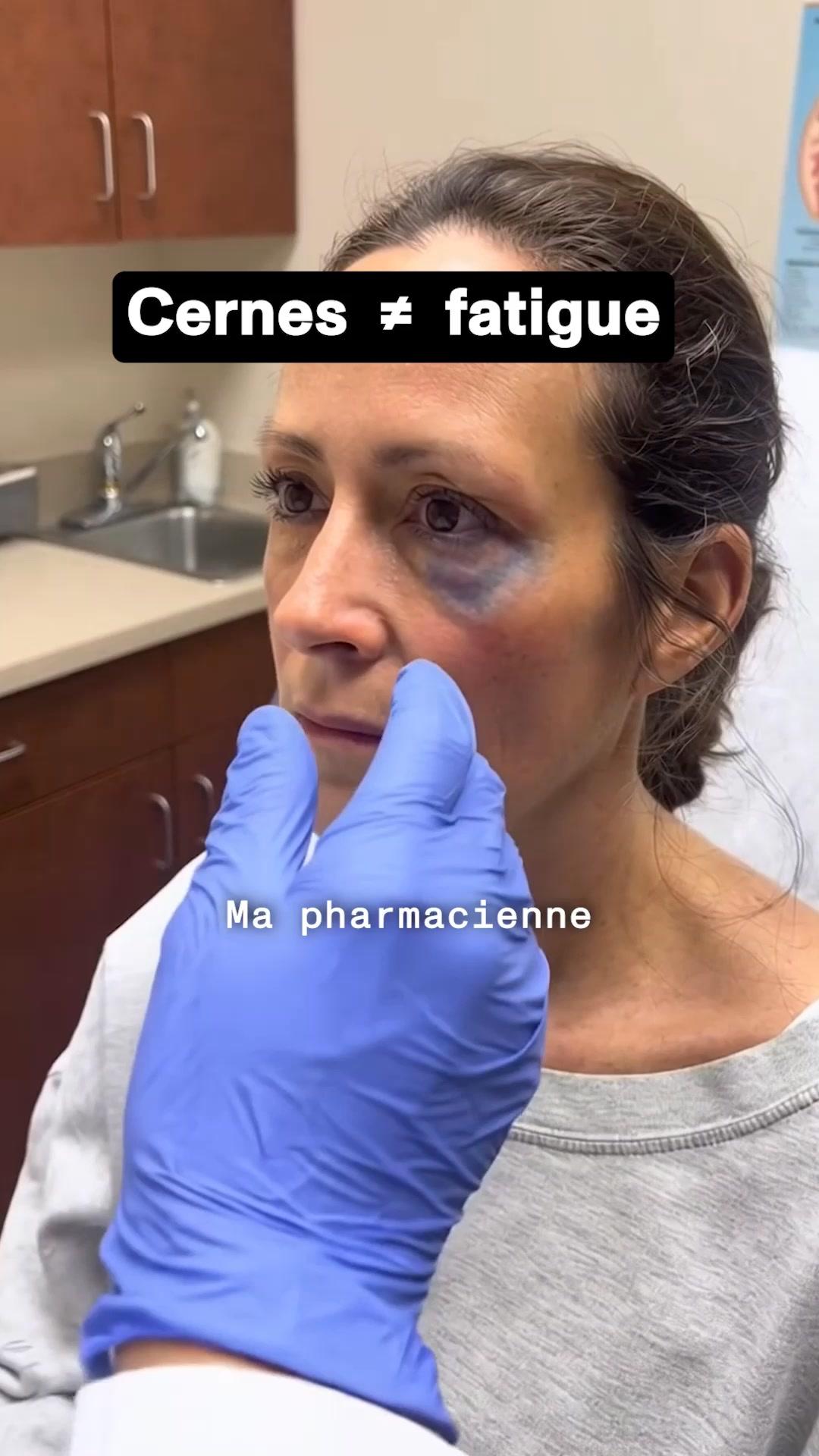 thumbnail-aloe-n-1-en-france-0