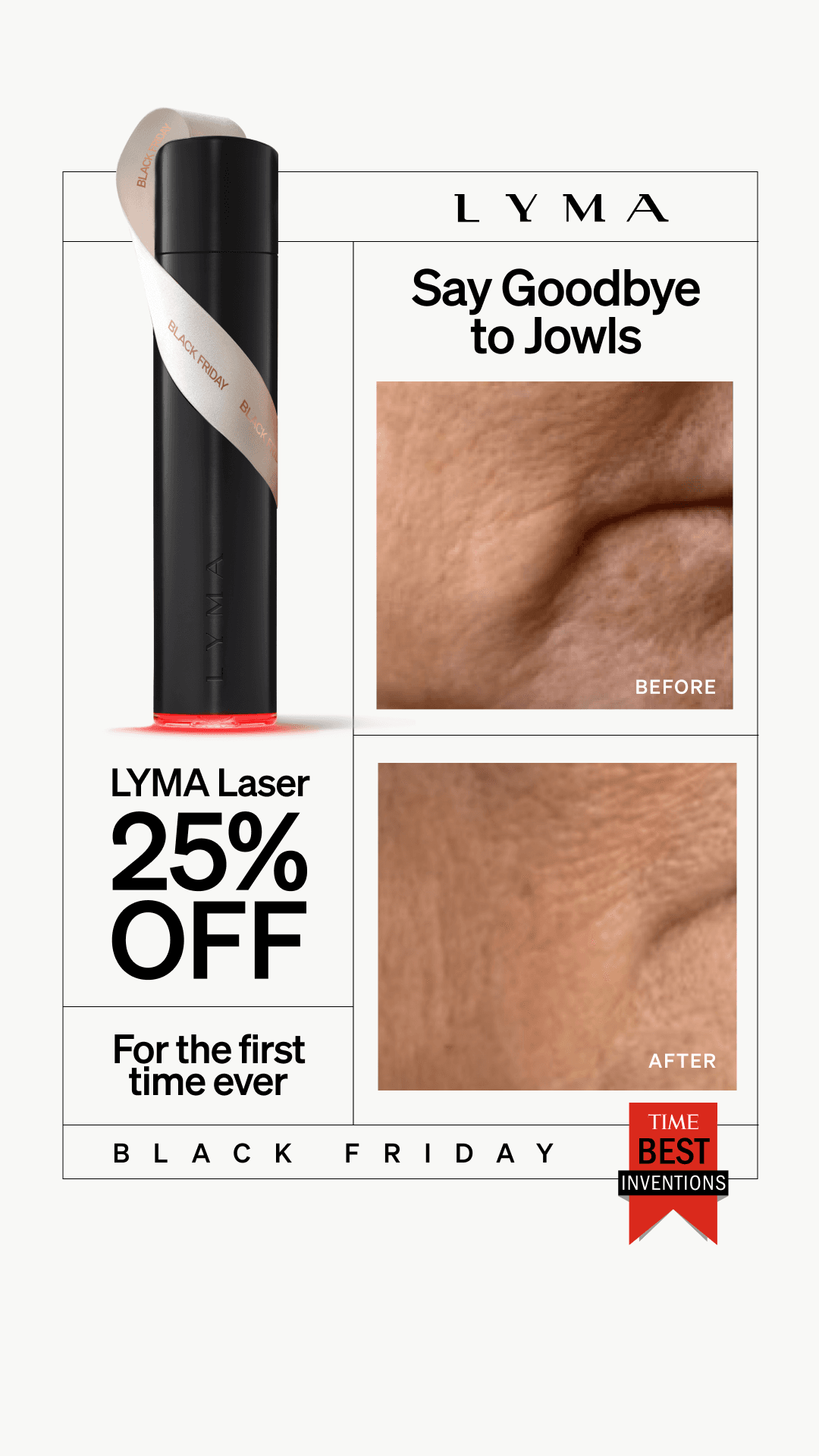 thumbnail-lyma-statique-before-after-0