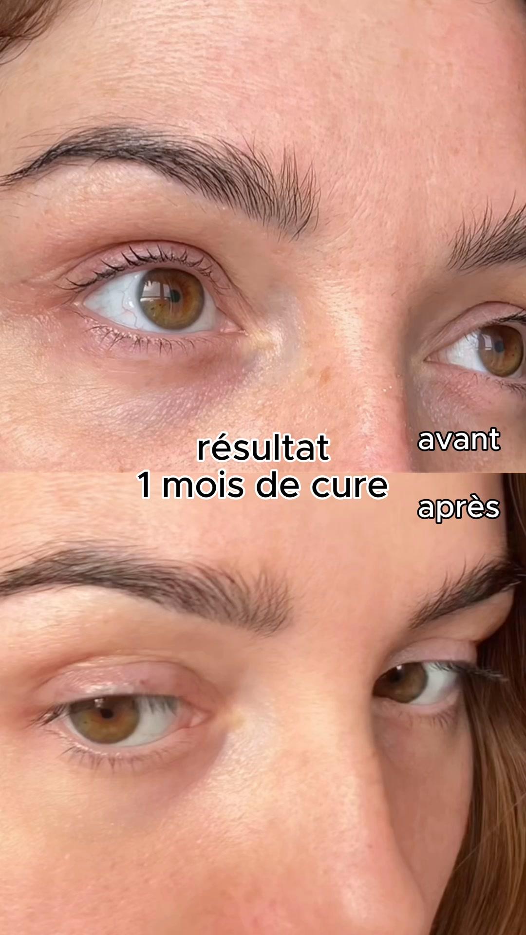 thumbnail-aloe-paris-before-after-0