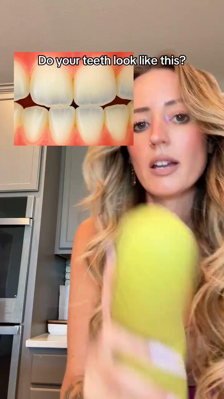 thumbnail-bite-shop-the-welcome-kit-0